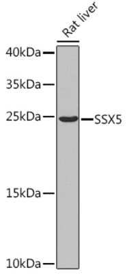 Western Blot: SSX5 AntibodyBSA Free [NBP2-93409]